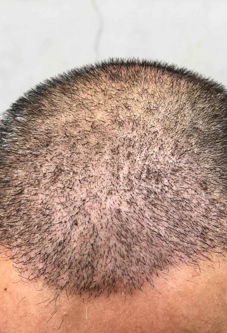 Why Patients Choose Mexico for Plastic Surgery and Medical Treatments