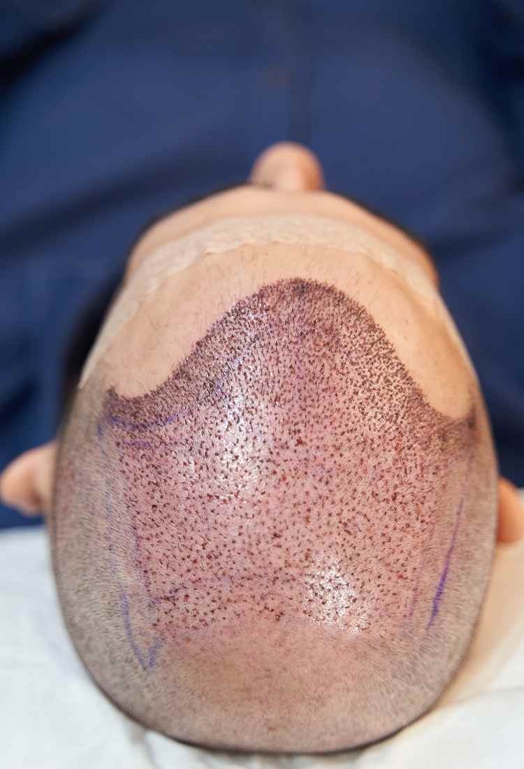 Premium Foot Care and Sports Medicine: 100 Pasos Podiatry in Spain